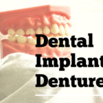 Dental Implant Dentures